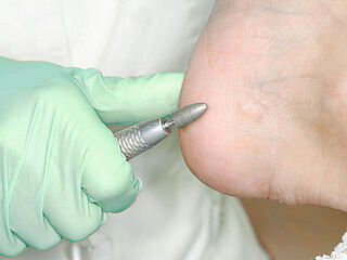 Fußbehandlung eines Patienten